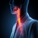 Understanding Ineffective Esophageal Motility